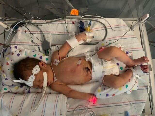 Blake post surgery