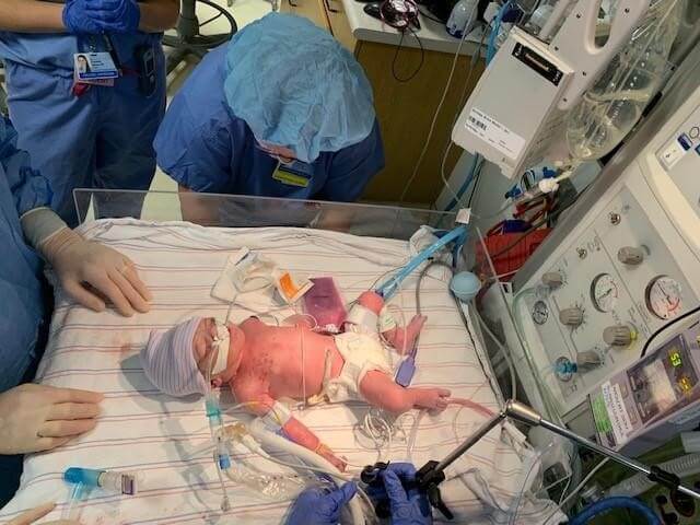 Blake pre-surgery